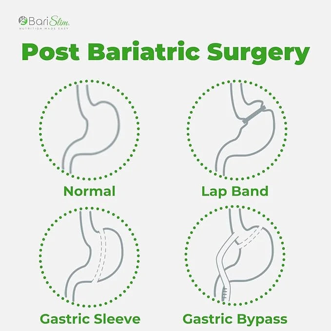 BariSlim Bariatric Calcium Citrate with Magnesium 500 mg (90 Servings)