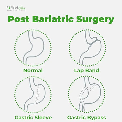 BariSlim Bariatric Calcium Citrate with Magnesium 500 mg (90 Servings)
