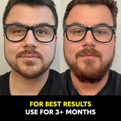 The Beard Club Biotin Vitamin Spray for Facial Hair Growth - Natural Formula for Fuller, Thicker Beard, Easy-to-Use, Nouri...