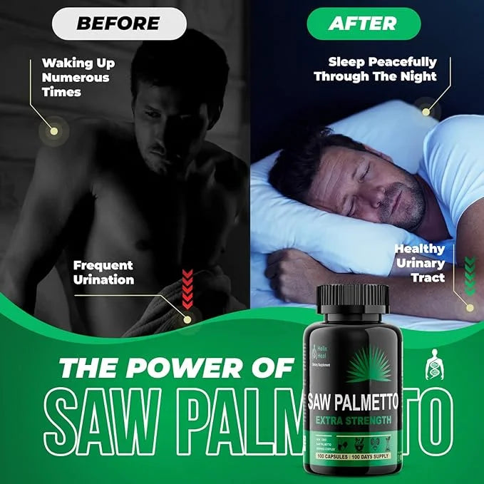 Saw Palmetto for Men - Prostate Health Supplements for Men Urinary Health - Natural DHT Blocker, 500mg Extra Strength Hair...