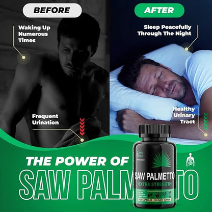 Saw Palmetto for Men - Prostate Health Supplements for Men Urinary Health - Natural DHT Blocker, 500mg Extra Strength Hair...