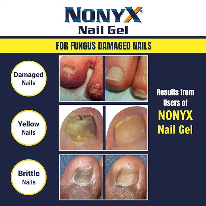 NONYX Fungal Nail Clarifying Gel 90% of 4 oz