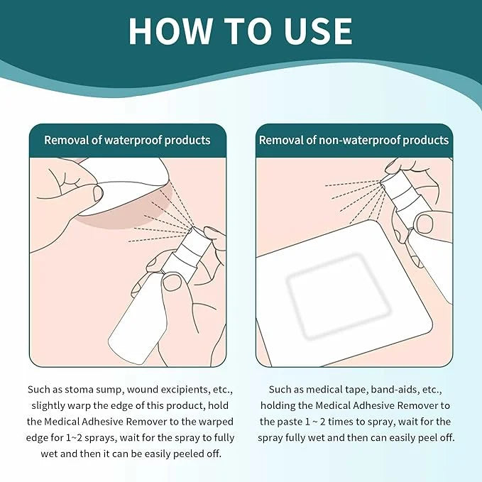Adhesive Remover Spray: Adhesive Remover for Skin 60mL)