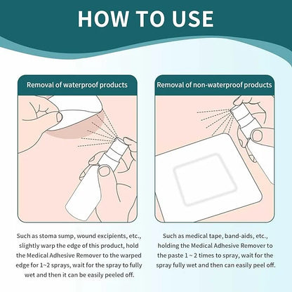 Adhesive Remover Spray: Adhesive Remover for Skin 60mL)