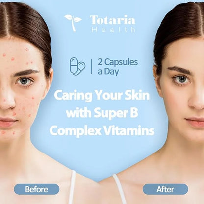 13-in-1 Vitamin B Complex Plus B1, B2, B2, B3 B3 (Niacinamide), B4, B5, B5, B6, B6, B7 B7 (Biotin), B8 (Inositol), B9 (Fol...