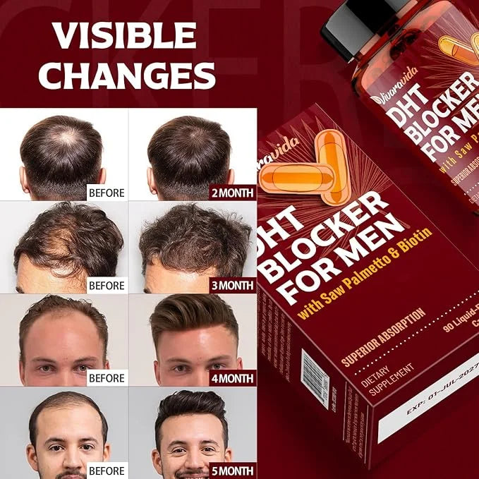 DHT Blocker for Men | Hair Growth Supplement with Saw Palmetto & Biotin - Hair Growth Vitamins - Hair Regrowth - Natural H...