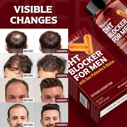 DHT Blocker for Men | Hair Growth Supplement with Saw Palmetto & Biotin - Hair Growth Vitamins - Hair Regrowth - Natural H...