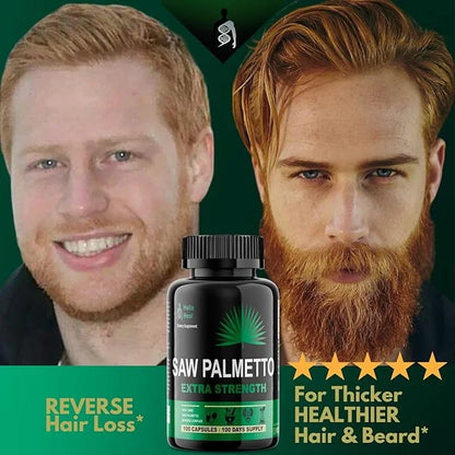 Saw Palmetto for Men - Prostate Health Supplements for Men Urinary Health - Natural DHT Blocker, 500mg Extra Strength Hair...