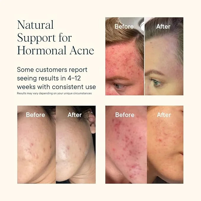 Ora Organic Natural Hormone Balance Supplement & Hormonal Acne Relief for Women - Support Skin, Mood, Energy, PMS & Menopa...