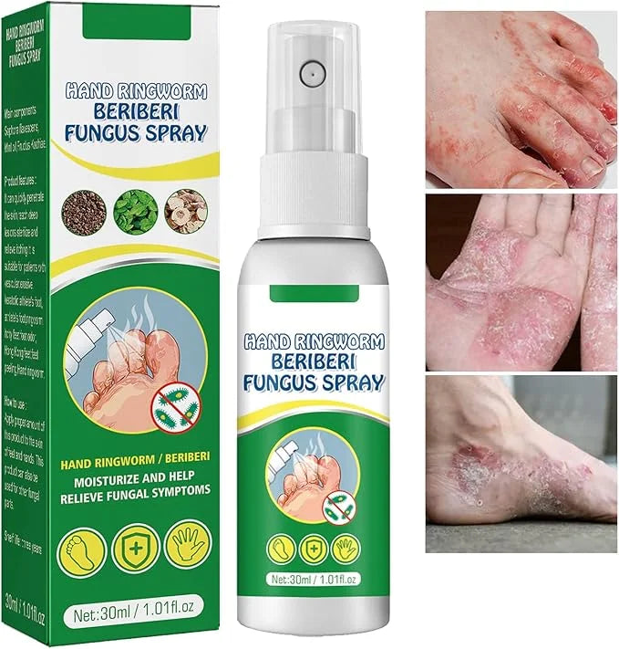 Athletes Foot Spray, Natural & Powerful