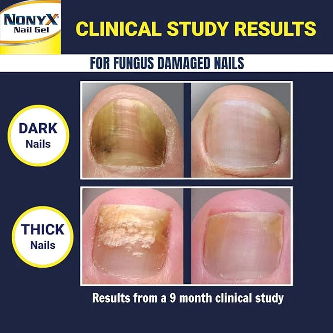 NONYX Fungal Nail Clarifying Gel 90% of 4 oz