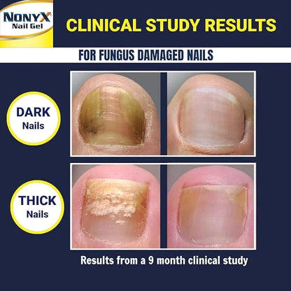 NONYX Fungal Nail Clarifying Gel 90% of 4 oz