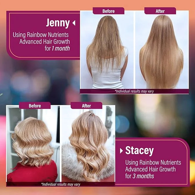 Hair Growth Vitamins for Women | Biotin 10,000mcg, Collagen, Patented OptiMSM®, goMCT®, Saw Palmetto | Naturally Regrow St...