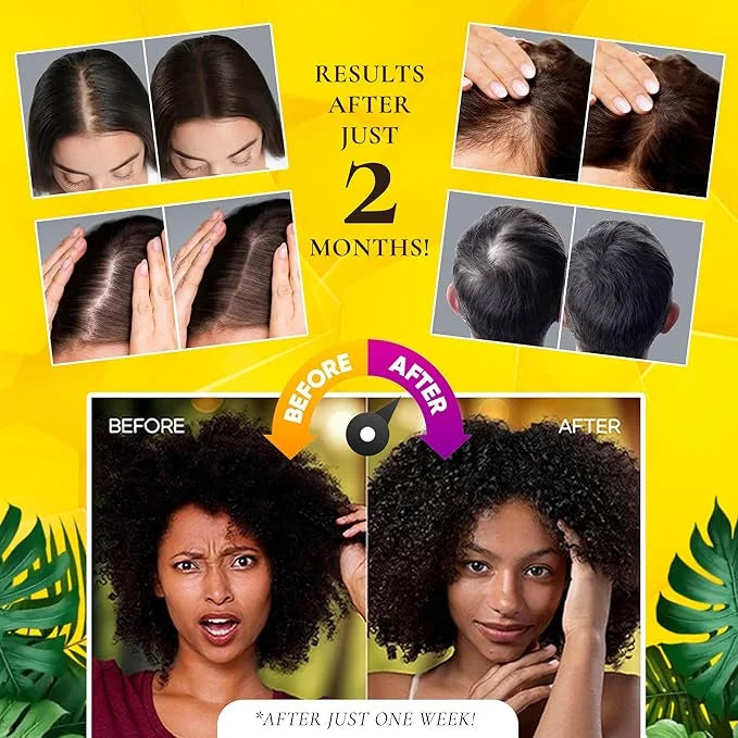 100% COLD-PRESSED (Unscented) Batana Oil - Thicker, Fuller Hair! Fights Thinning & Promotes Growth. A Hair & Scalp 'SUPERF...