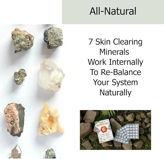 Eczema Pill – Natural Eczema Treatment – Dermatologist Developed – 7 All Natural Minerals Clear & Prevent Eczema Scaling, ...