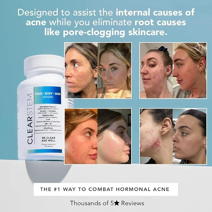 CLEARSTEM - MINDBODYSKIN Hormonal Acne Supplement (5-HTP) - Natural DIM Supplement - Skin Care Vitamins - Hormone Balance,...