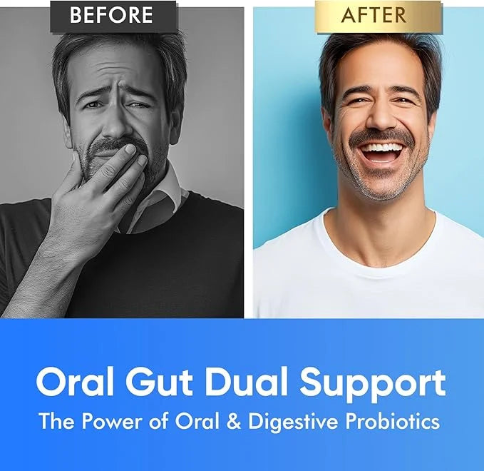 120 Capsules Oral Probiotics, Enhanced Super Digestive Enzymes & Probiotics-Oral Gut Dual Support-8 Strains 22 Billion CFU...