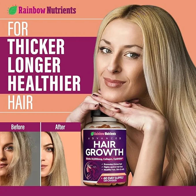 Hair Growth Vitamins for Women | Biotin 10,000mcg, Collagen, Patented OptiMSM®, goMCT®, Saw Palmetto | Naturally Regrow St...