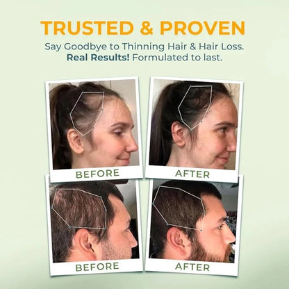 Vital Hair Complex – Biotin &
