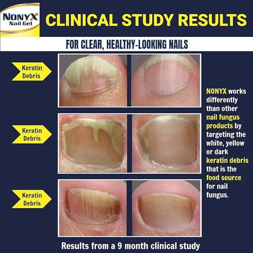 NONYX Fungal Nail Clarifying Gel 90% of 4 oz